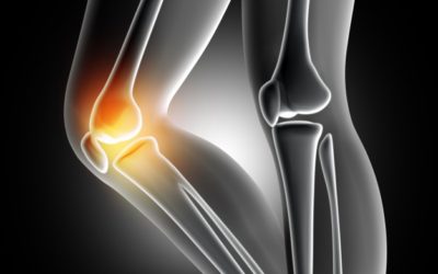 サルコペニアと診断！？緩和のために必要な筋力トレーニングとは